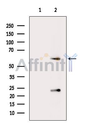 CCDC47 Antibody - Western blot analysis of extracts from Hela cells(heat-shock treatment), using CCDC47 Antibody.