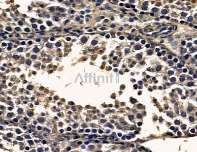 CCDC47 Antibody - DF16020 at 1/100 staining mouse testis tissue by IHC-P.