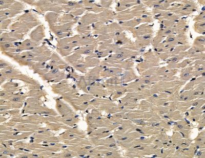 CCDC47 Antibody - DF16020 at 1/100 staining rat heart tissue by IHC-P.