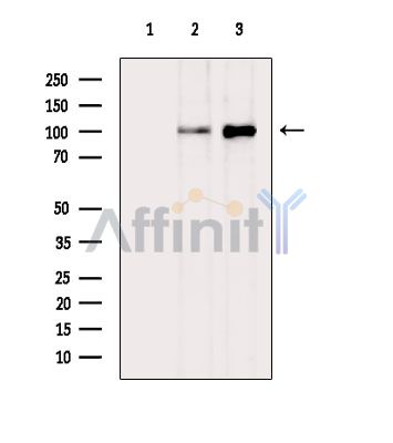 DSC1 Antibody - Western blot analysis of extracts from various samples, using DSC1 Antibody.