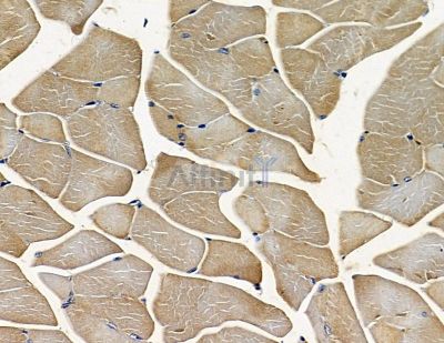 GET4 Antibody - DF16039 at 1/100 staining mouse muscle tissue by IHC-P.