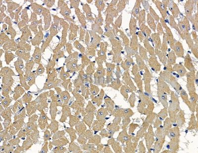 GET4 Antibody - DF16039 at 1/100 staining rat heart tissue by IHC-P.