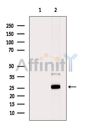 RNF166 Antibody - Western blot analysis of extracts from HepG2 cells(heat-shock treatment), using RNF166 Antibody.