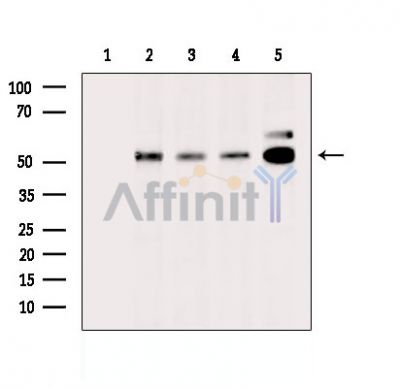 MINDY1 Antibody - Western blot analysis of extracts from various samples, using MINDY1 Antibody.