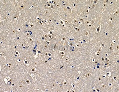 ZNF233 Antibody - DF16056 at 1/100 staining mouse brain tissue by IHC-P.