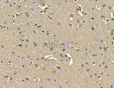 ZNF468 Antibody - DF16059 at 1/100 staining rat brain tissue by IHC-P.