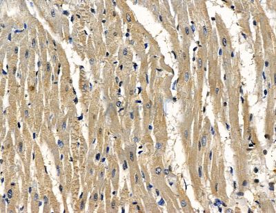 CLRN3 Antibody - DF16063 at 1/100 staining rat heart tissue by IHC-P.