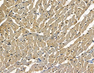 PPM1H Antibody - DF16066 at 1/100 staining rat heart tissue by IHC-P.
