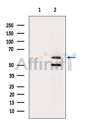 ANKRD13C Antibody - Western blot analysis of extracts from Hela cells(heat-shock treatment), using ANKRD13C Antibody.