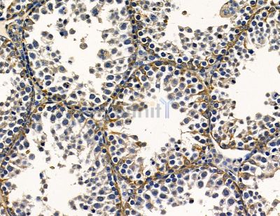 ANKRD13C Antibody - DF16067 at 1/100 staining mouse testis tissue by IHC-P.
