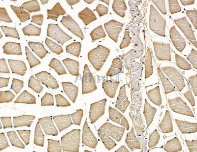 LRRCC1 Antibody - DF16075 at 1/100 staining rat muscle tissue by IHC-P.