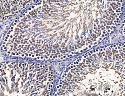 TTC30A Antibody - DF16077 at 1/100 staining rat testis tissue by IHC-P.