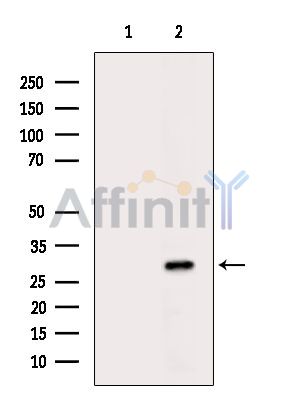 CYB5R3 Antibody - Western blot analysis of extracts from Mouse brain, using CYB5R3 Antibody.