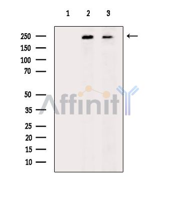 PTPRK Antibody - Western blot analysis of extracts from HepG2 cells(heat-shock treatment) Hela cells(heat-shock treatment), using PTPRK Antibody.
