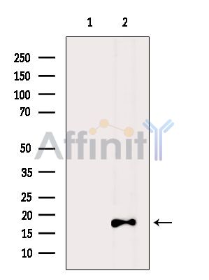 TOMM20 Antibody - Western blot analysis of extracts from Rat lung在20左右, using TOMM20 Antibody.
