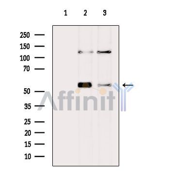TGFBR1 Antibody - Western blot analysis of extracts from various samples, using TGFBR1 Antibody.
