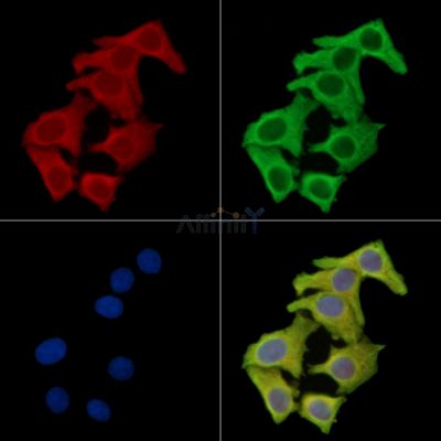 IL-1R9 Antibody - AF9096 staining Hela cells by IF/ICC.