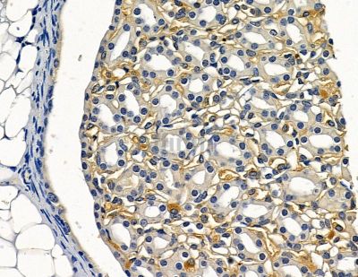 ATP6V0A2 Antibody - DF10006 at 1/100 staining mouse kidney tissue by IHC-P.
