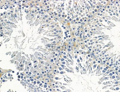 AKAP4 Antibody - DF10048 at 1/100 staining rat testis tissue by IHC-P.