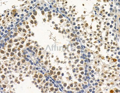 UL97 Antibody - DF10054 at 1/100 staining mouse testis tissue by IHC-P.