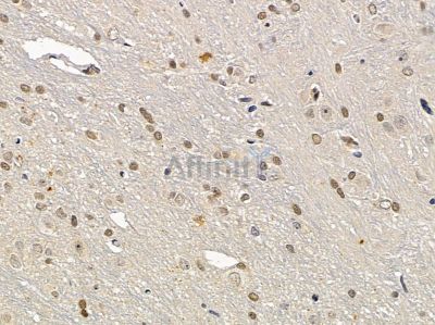 CIC Antibody - DF10074 at 1/100 staining rat brain tissue by IHC-P.