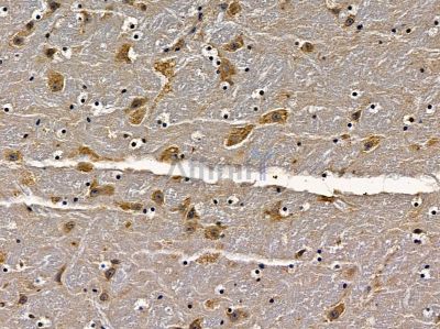 CDYL1 Antibody - DF10088 at 1/100 staining mouse brain tissue by IHC-P.
