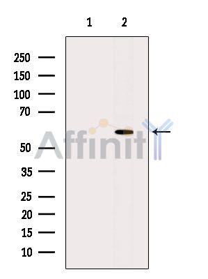 DYRK2 Antibody - Western blot analysis of extracts from HepG2 cells(heat-shock treatment), using DYRK2 Antibody.