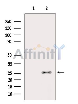CLEC6A Antibody - Western blot analysis of extracts from HepG2 cells(heat-shock treatment), using CLEC6A Antibody.