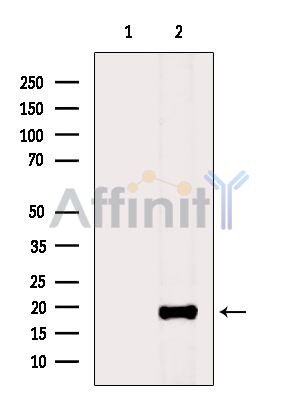 REG4 Antibody - Western blot analysis of extracts from Hela cells(heat-shock treatment), using REG4 Antibody.