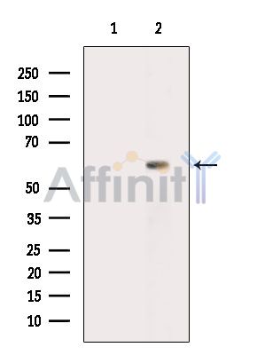 ADHFE1 Antibody - Western blot analysis of extracts from Hela cells(heat-shock treatment), using ADHFE1 Antibody.