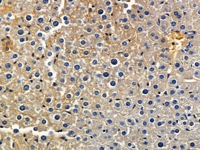 DENR Antibody - DF12938 at 1/100 staining mouse liver tissue by IHC-P.