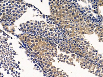INTS3 Antibody - DF13092 at 1/100 staining mouse testis tissue by IHC-P.