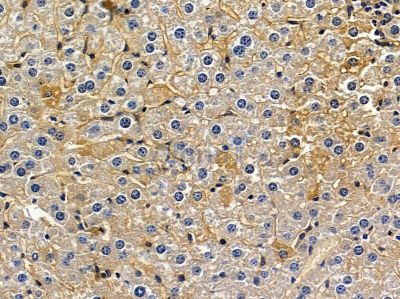 KIF26B Antibody - DF13110 at 1/100 staining mouse liver tissue by IHC-P.