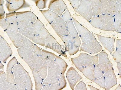 Ninein - Centrosome Marker Antibody - DF13256 at 1/100 staining mouse muscle tissue by IHC-P.