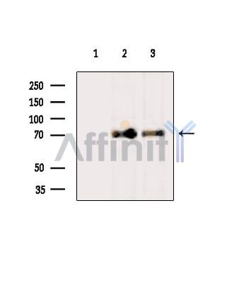 ADAMTS5 Antibody - Western blot analysis of extracts from various samples, using ADAMTS5 Antibody.