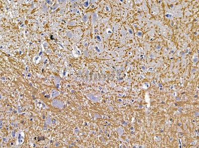Myelin PLP Antibody - DF13282 at 1/100 staining rat brain tissue by IHC-P.