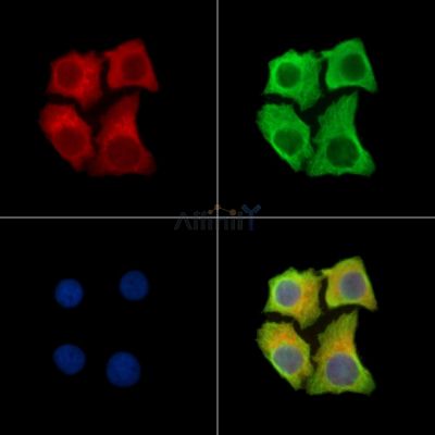 KRT80 Antibody - DF13763 staining Hela cells by IF/ICC.