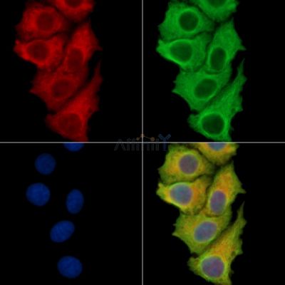 Calpastatin Antibody - DF13778 staining Hela cells by IF/ICC.