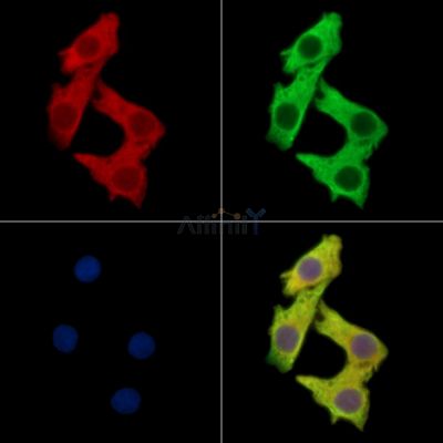ANKHD1 Antibody - DF13880 staining Hela cells by IF/ICC.