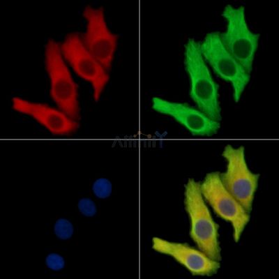 SLCO4A1 Antibody - DF13888 staining Hela cells by IF/ICC.