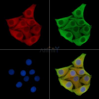 RNF135 Antibody - DF13982 staining Hela cells by IF/ICC.