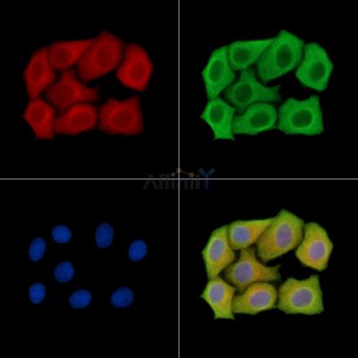 Kv1.8 Antibody - DF13986 staining Hela cells by IF/ICC.