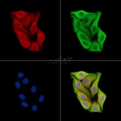 NALP2 Antibody - DF13994 staining Hela cells by IF/ICC.