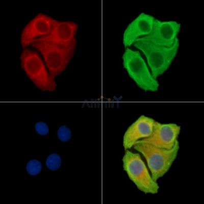 DPP8 Antibody - DF13999 staining Hela cells by IF/ICC.