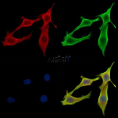 Hrk Antibody - DF14002 staining Hela cells by IF/ICC.