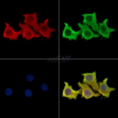 REG1 alpha Antibody - DF14006 staining Hela cells by IF/ICC.