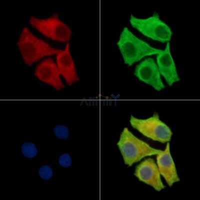 Chimaerin 2 Antibody - DF14029 staining Hela cells by IF/ICC.