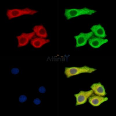 SLC35B1 Antibody - DF14032 staining Hela cells by IF/ICC.