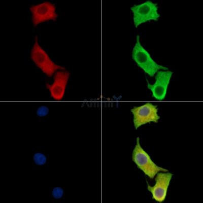 SLC5A4 Antibody - DF14033 staining Hela cells by IF/ICC.