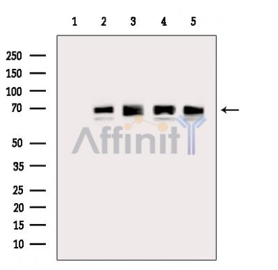 DLAT Antibody - Western blot analysis of extracts from various samples, using Pyruvate Dehydrogenase E2 Antibody.